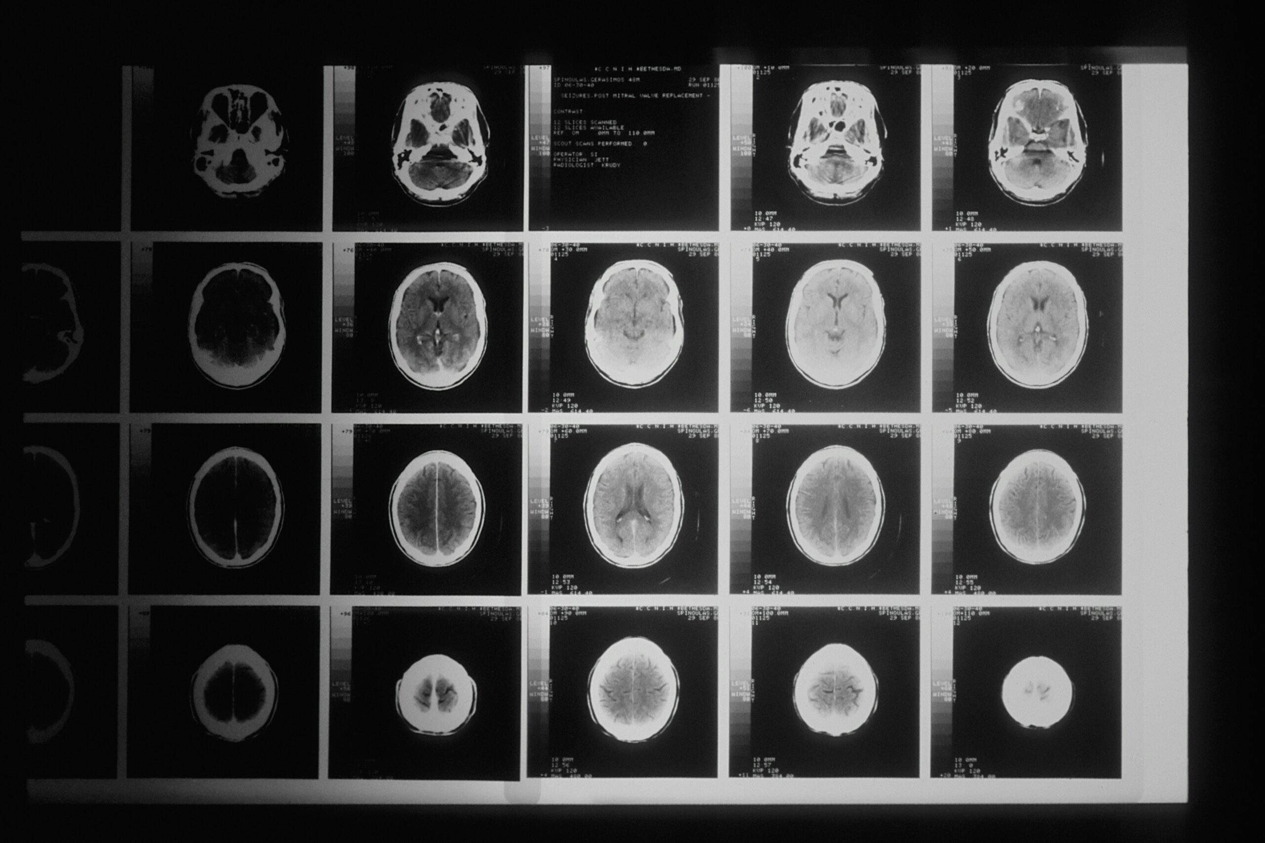 CT Scan Explained Pokemon Card